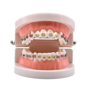 Altro modello di trattamento ortodontico dentale per l'igiene orale con staffa orto in metallo ceramica filo ad arco tubo buccale legature legature strumenti dentali laboratorio dentista 230425