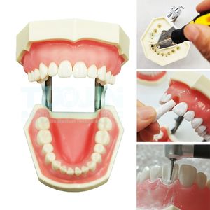 Other Oral Hygiene Dental 28pcs Removable Resin Teeth Soft Gums Typodont Tooth Model Preparation Student Oral Teaching Practice Product 230617