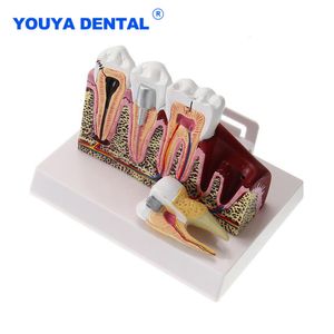 Övrig oral hygien Anatomisk struktur Modell Standard Dental Oral Teeth Teaching Model Comprehensive Tooth Dentist Dental Student Demonstration 230617