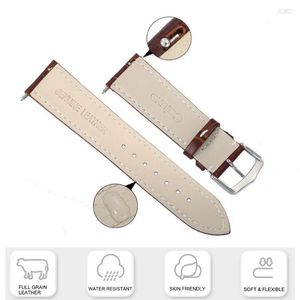 Pulseiras de relógio Moda Masculina Feminina Correia de couro genuíno Barras de mola de liberação rápida Ferramenta de substituição gratuita Relógio de pulso Largura da pulseira 20 mm 22 mm