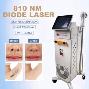 NOWOŚCI DIODE LASER 755 808 1064NM 808 MASZYNU URUCHOMOŚCI HARDY OSTRZEŻNY Efekt Usuń włosy root Salon Salon Salon Salon