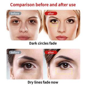 Rf Radio Frequency Eye Massager Anti Ageing Wrinkle Portable Electric Device Dark Circle Facials Vibration Massage Pen 220516