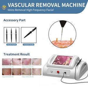 Macchina laser RF Rimozione vascolare ad alta frequenza Trattamento delle vene varicose Rimozione dei vasi sanguigni Rimozione della vena del ragno