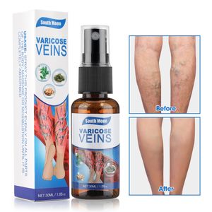 best selling Varicose Veins treatment essential oil Relief Phlebitis Angiitis Remedy Pain Spray for Spider Veins Edema Nerve Pain Leg Pain Ra
