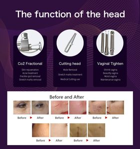 CO2 RF Lasermarkeringsmaskin Fraktionsmärken Borttagning Skönhetsmaskin 10600nm Sensorbehandling före och efter Agent Price