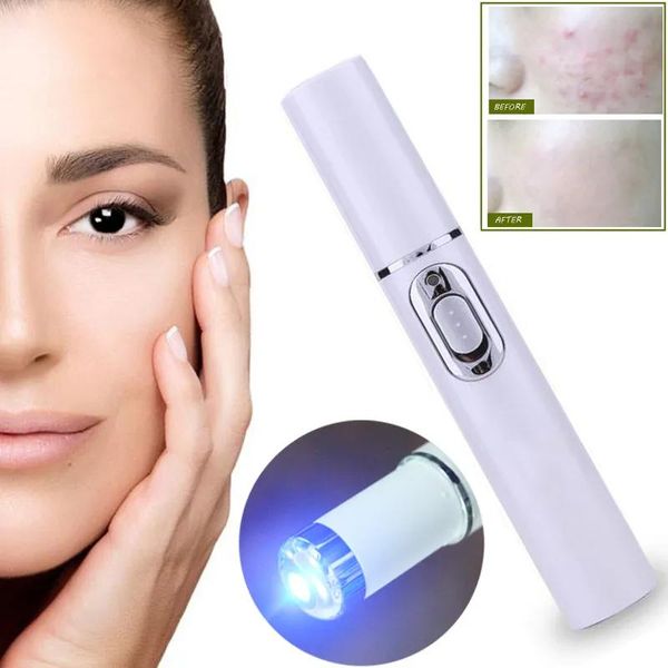 Gadgets máquina portátil durável macio cicatriz acne azul luz terapia caneta massagem aranha veia borracha