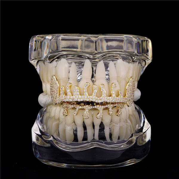Personalisierte Wassertropfen-Zahnprothesen-Zahngitter mit unregelmäßigen diamantgefüllten Goldspangen, die mit Zahngittern aus echtem Gold überzogen sind