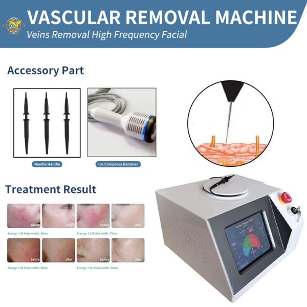 Macchina laser La rimozione vascolare ad alta frequenza RF Rimozione della vena del ragno dei vasi sanguigni221