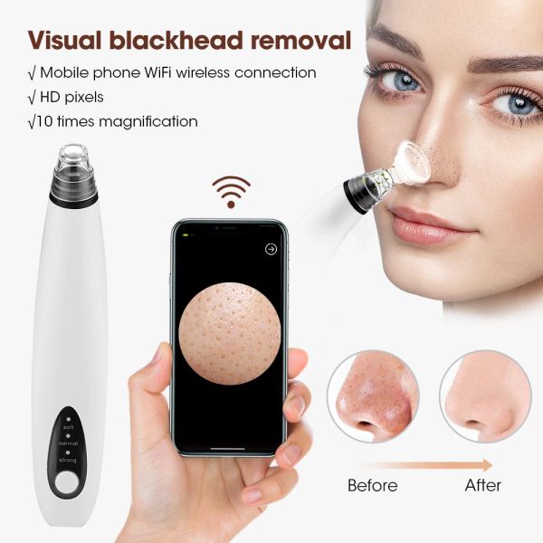 Removedores visuais removedor de cravo vácuo limpeza facial acne limpador wifi microscópio câmera rosto beleza manchas pretas remoção cuidados com a pele