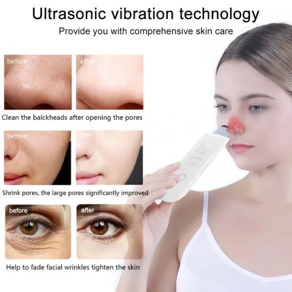 Dispositivos ultra-sônicos pá de cravo purificador de pele peeling removedor de cravo limpeza profunda rosto poros cabeça preta acne dispositivos de beleza ferramenta