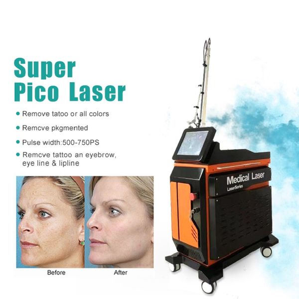 Macchina a picosecondi Rimozione permanente dei pigmenti Pico second Laser tatuaggio Rimuovi i laser ND Yag Pico Laser Picosecond Voglia Rimozione lentiggine Ringiovanimento della pelle