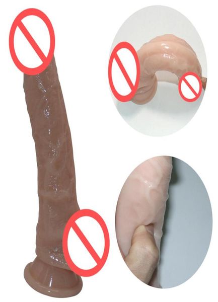 Feminino masturbação galo skinfeeling pênis realista super enorme grande vibrador com ventosa brinquedos sexuais para mulher produtos sexuais 4585464