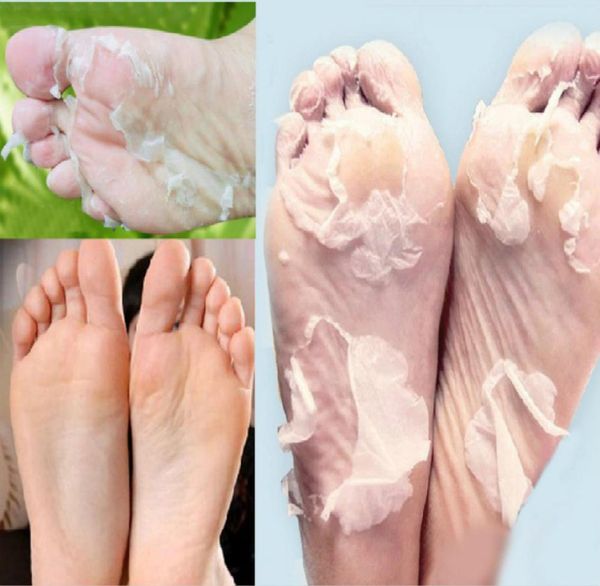 Rosotena esfoliante tratamento pé máscara meias para pedicure bebê casca pés máscaras cuidados com a pele cosméticos peeling suso2274395