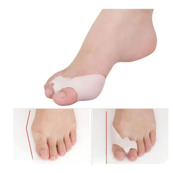 2024 1 pair silikon jel ayak parmakları İki delikli ayak parmağı ayırıcı başparmak valgus koruyucusu Bunion ayarlayıcı halüke valgus koruyucu ayaklar- Bunion için