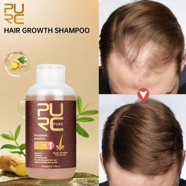 Prodotti Purc Ginseng Ginger Capelli Shampoo e Condizionatore perdita di peli antidandruffta cuoio capelluto Trattamento levigante la cura dei capelli