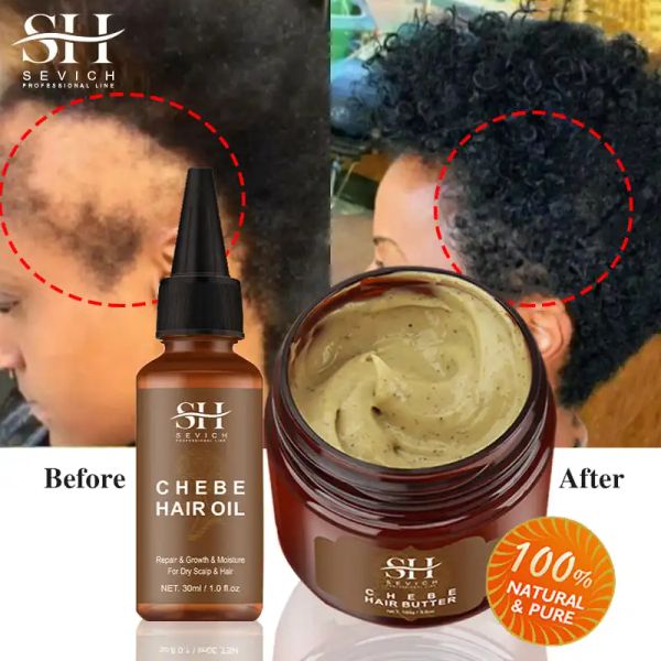 Shampoocondicionador Africa Traction alopecia Cabinete Óleo de crescimento 100g Hidrato hidratante Máscara de cabelo Tratamento de perda de cabelo Crazy Epickle Hair Care Sevich