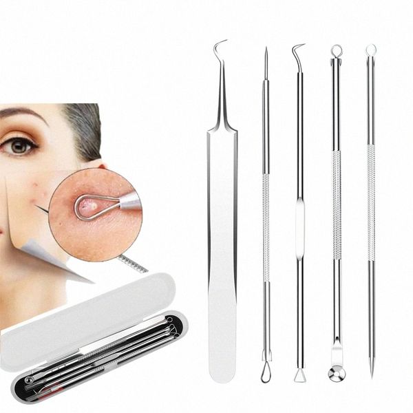 5 PCS removedor de cravo comedes extrator kit de remoção de acne para manchas, whitehead pop, zit remoção para nariz rosto ferramentas g80L #