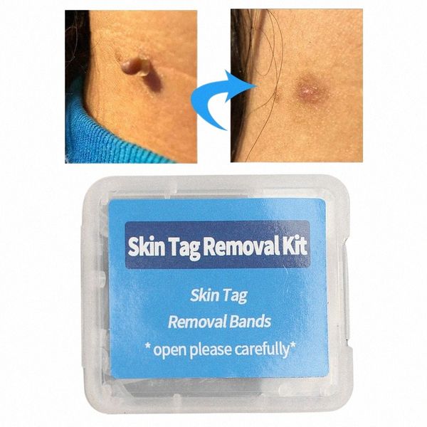 30 pz / scatola Kit di elastici per la rimozione della talpa N-tossico Kit per il trattamento dell'acne brufolo Strumento per il trattamento della verruca per le donne degli uomini Cura della pelle del viso 64lP #