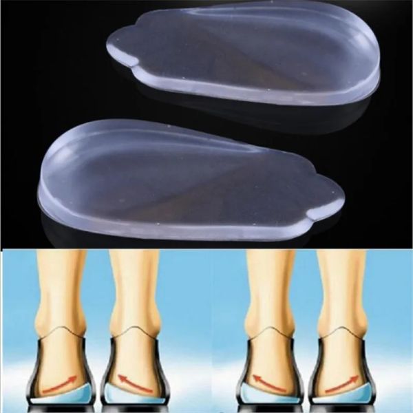 2pcs silicon Inoleole Orthesen X/O-Beinkorrektur Corrector Gel Kissen für Fersen-Orthopädische Einlegesüben Schuhepolster für Füße Pflege