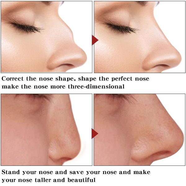 Nase ätherische Ölhebexhöhung erhöhte die Nasenkorrekten Kollagen fest feuchtigkeitsspendende Nasenform Serum -Reshape natürliche Gesichtshautpflege