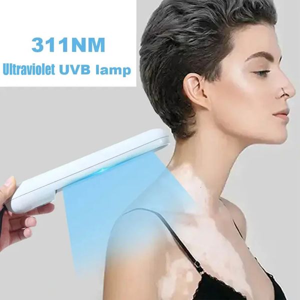 UVB Ultraviolet Poterapy Strument Vitiligo Trattamento LASER LASER UV per terapia Psoriasi Pagina cutanea 240430 240430