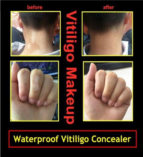 Penna per cavaliere per il viso in vitiligo impermeabile per coprire le mani del corpo leukasmus bianco nascondere la pelle leucoderma trucco istantaneo liquido PE3863502