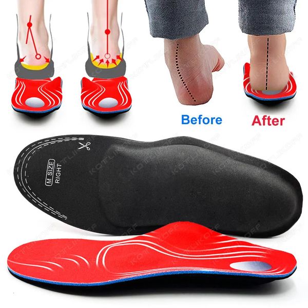 Eva Orthopädische Schuhe Sohle Einlegesole für Schuhe Arch Fußpad xo Bein Korrektur Flat Fußbogen Unterstützung Sportschuhe Einsatz 240506