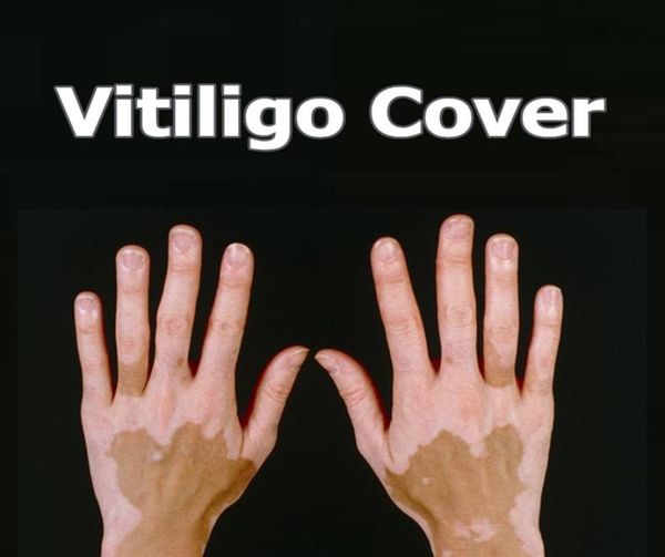 Vitiligo Centador Líquido Pen do Vitiligo à prova d'água Patches naturais Hide leucoderma Solução de cobertura de maquiagem instantânea para desmaios de pele5449494