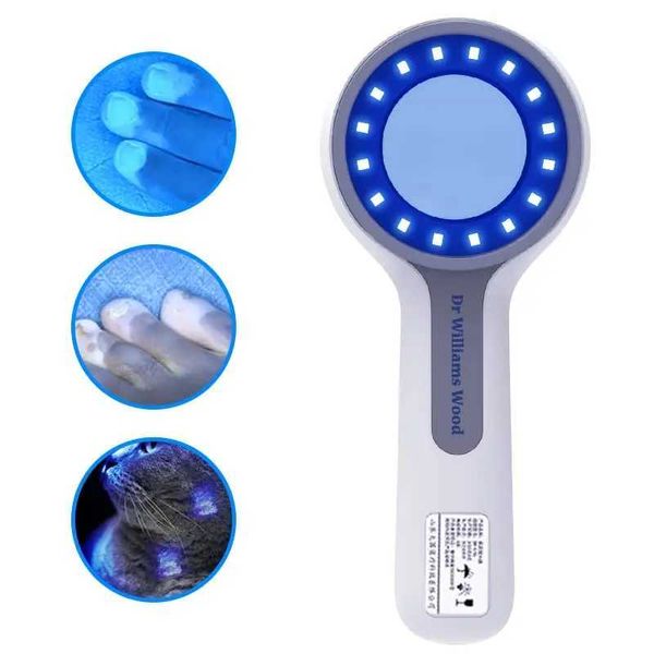 Instrumento de beleza em casa Vitiligo Skin Analyzer Detector Fúngico Profissional Mosso Facial Tinea Spa Salão Q240508