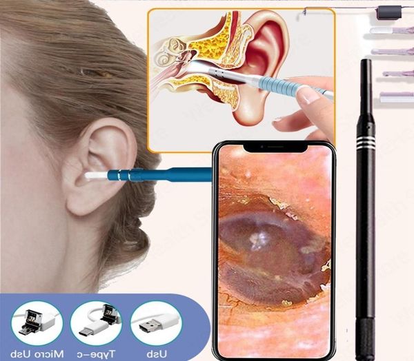 Outros itens de beleza de saúde Otoscópio de câmera de endoscópio de orelha para o kit de picareta médica Limpeza da ferramenta de remoção de cera Ear Sticks e8784054