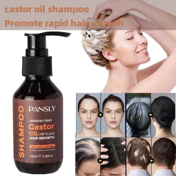 Shampoos Castor Shampoo Limpeza Profunda Antidandruff Antipruryic Oil Control Cabelo Cabelo Cabelo Capilar Crescimento Efetivo para perda de cabelo