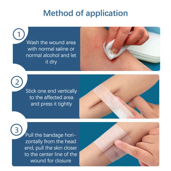 1Set atmungsaktives Band Aid wasserdichte Verband Erste Hilfe Wundverkesste Medizinische Klebeband Wundpflaster Notfall -Kits Bandaids