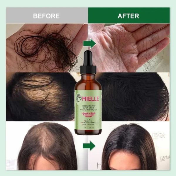 Haarwachstum ätherisches Öl Rosmarin Minz Haar stärken Ölfürchtigen für Split -Enden und trockene Mielle Organics Haare.