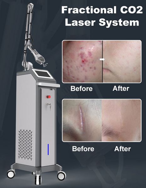 Neueste fraktionale CO2 -Lasersystem Skin Care Beauty Machine Entfernen Sie Narben Hautstraffung Multifunktionales Gerät für kommerziell