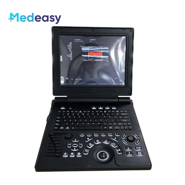 Display HD de 12 polegadas Scanner de ultrassom portátil Doppler 3D Máquina de gravidez de ultrassom