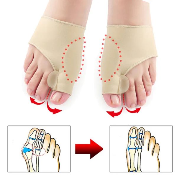 2pcs = 1Pair dedo dedo corretor ortono de pé de péfocos de pés de ósseo Correção de ponte de polegar Soft Pedicure Meocks Bunion Alisão