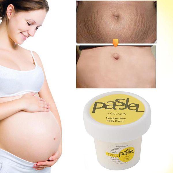 2x Narbenreparaturcreme-Dehnungsmarken Remover-Creme-Fettleibigkeit Marke Anti-Aging-Körpers Gesundheitsversorgung für postpartale schwangere Frauen