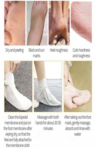 1BAG2PCS Calzini per maschere esfoliante per i calzini a pedicure per i piedi che sbucciano la maschera per la cura della pelle per la cura della pelle rimozione della pelle morta1304569