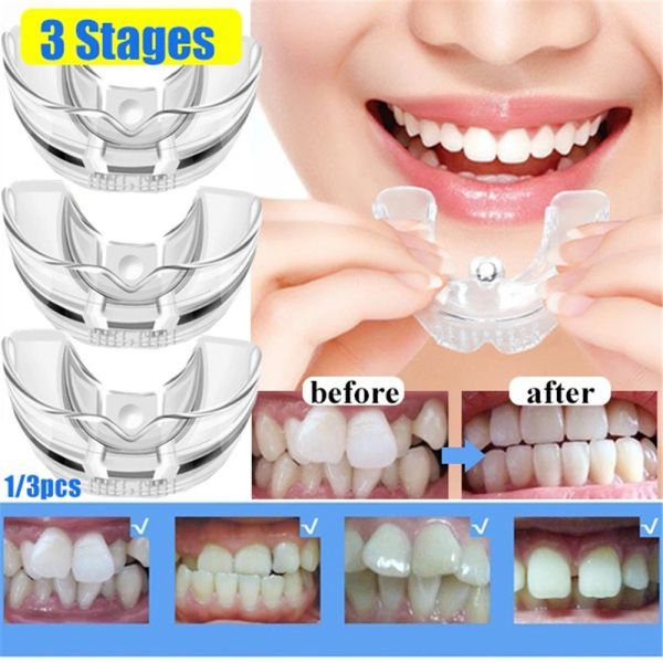 3 estágios de dente de silicone