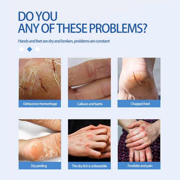 Cura della pelle invernale Piede anti-asciugatura Anti-Canna Crema Crema Cremata Spattoni Crappa idratante per la cura delle mani e del piede nutriente