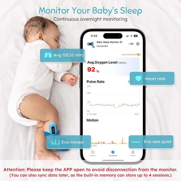 Monitor de oxigênio para bebês com Bluetooth e App - Rastrear AVG O2, taxa de pulso e movimento para bebês 0-36 meses - Monitor de pé vestível para recém -nascidos sono