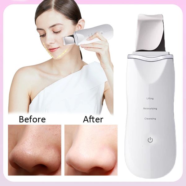 Removedor elétrico de lavador de pele Remover descascando a limpeza profunda Face Pore Limpador Importação de Íons Faciais Ferramentas de beleza de limpador de pá facial 240419