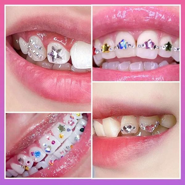 Zähne Schmuck Herzperlen Oraldekor 1 Set Zahnkristall Diamant Ornament DIY -Werkzeuge Verschiedene Formen Farbkleber sind nicht enthalten