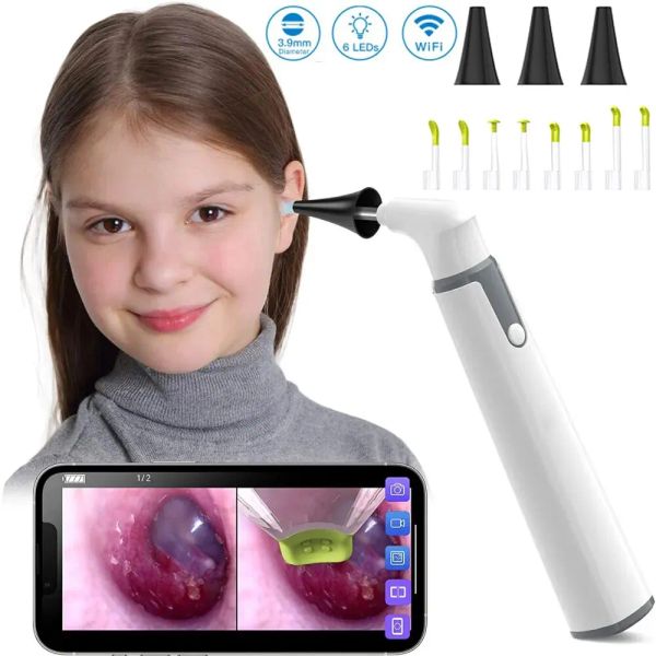 Câmera de ouvido de câmeras Endoscópio de 3,9 mm Otoscópio sem fio 720p HD WiFi Ear Scope com 6 LED para crianças e adultos Apoio Android iPhone ip67