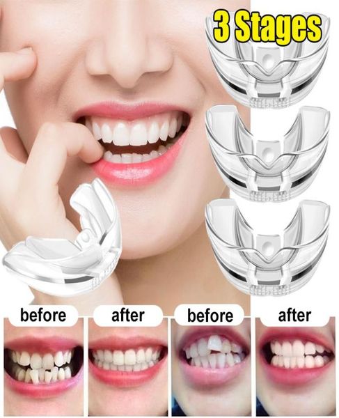 1pc Brace ortodôntico Brace dental Brace Dental Alinhamento de Silicone Dentes de retenção de retenção do retenção de dentes da bocal de dentes de dentes