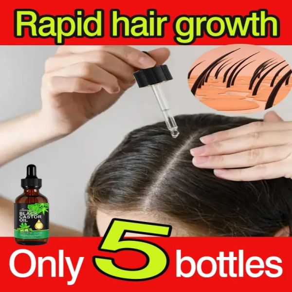 Shampoocondicionador Jamaicano Black Castor Óleo Cabelo Crescimento Os Cílios das sobrancelhas Cabelo e Corpo Cuidado Óleo Puro Orgânico Pressado Óleos de Castura não refinados