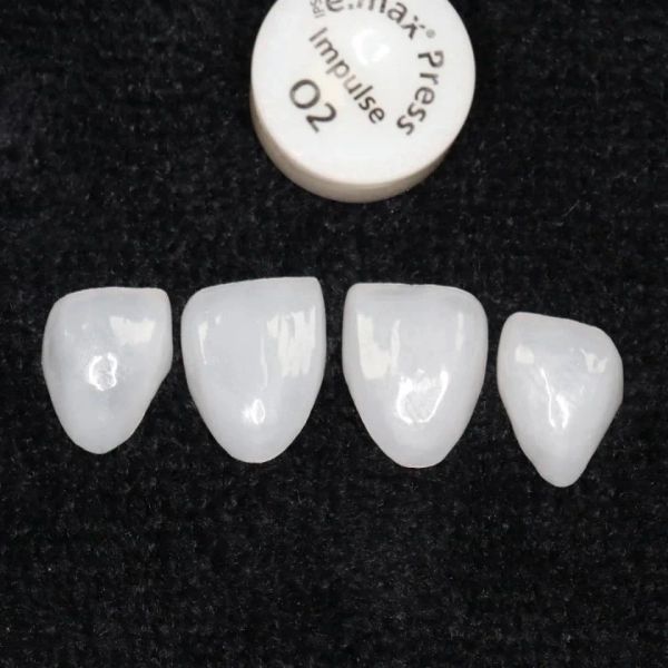 Modell Nr. 41# 2pcs Zähne Furnier Zahnweihweiß -Zahnkeramikverbundporzellan Klinik anterior hellweiß Lowre Medium klein