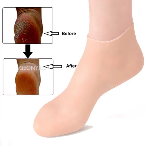 Tool 1Pair Feet Care Meocks Spa Home Use Novo Silicone Hidratante Gel Socks Socks Rachado Protetores de Cuidados de Pele Skin Anti Cracking