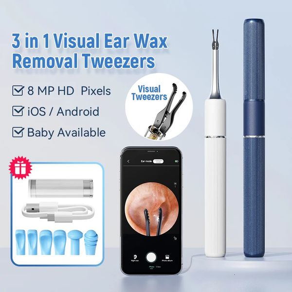 Wireless Smart Ear Puloning Endoscopio Visual Piecing Pinting Otoscopio Celefiette per la cera per la rimozione della cera per la cera per la cera per cere