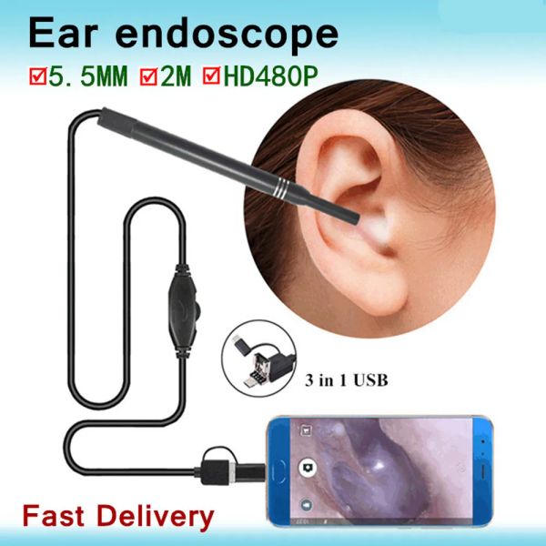 Controlli Endoscopio Pulitore per orecchie Fotocamera Otoscopio trasparente Pulizia medica dell'orecchio Pulitore per la rimozione della cera Dispositivo trasparente per l'orecchio Strumento per la rimozione della cera Cura dell'orecchio